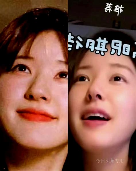 Zhao Lusi Was Caught Up In The Plastic Surgery Controversy Her Double