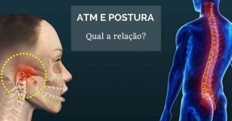 Fisioterapia no Tratamento das Disfunções da ATM articulação