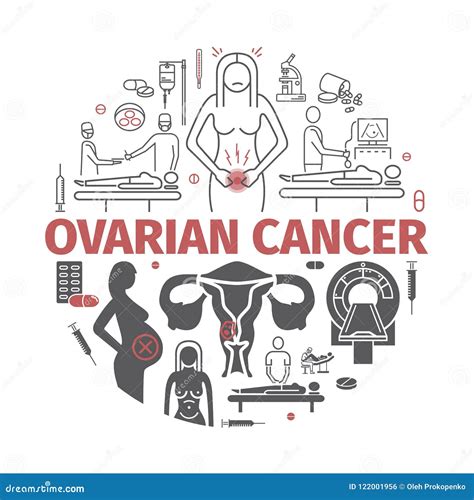 Symptoms Of Ovarian Cyst Ovaries Structure Infographics Vector