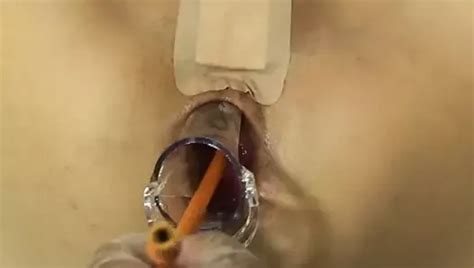 Elmer S Wife Anal Fisting Speculum Japanese Porn Xhamster