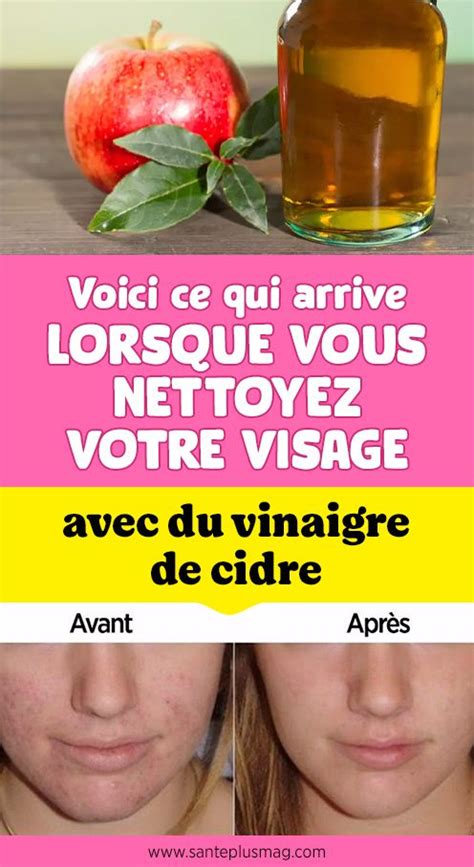 Vinaigre de cidre 6 bienfaits beauté comment lutiliser pour la peau