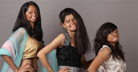 Indian Acid Attack Victims Bravely Star In Empowering Photoshoot Huffpost Uk Life