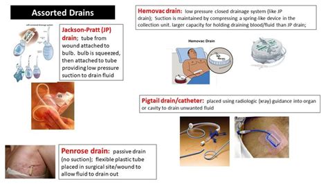 Surgical Wound Drains Summary