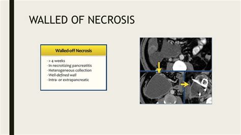 Acute Abdomen Imaging 2pptxacute Abdomen Imaging 2pptxacute Abdomen