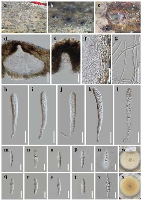 Pseudokeissleriella Bambusicola Facesoffungi Number FoF 12708