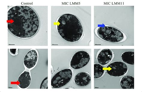 Transmission Electron Microscopy Of Candida Albicans Reference Strain