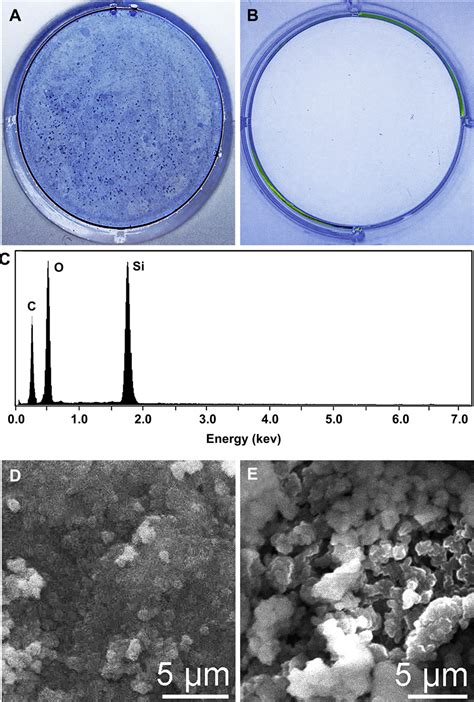 Figure 2 From The Role Of Biosilica In The Osteoprotegerinrankl Ratio