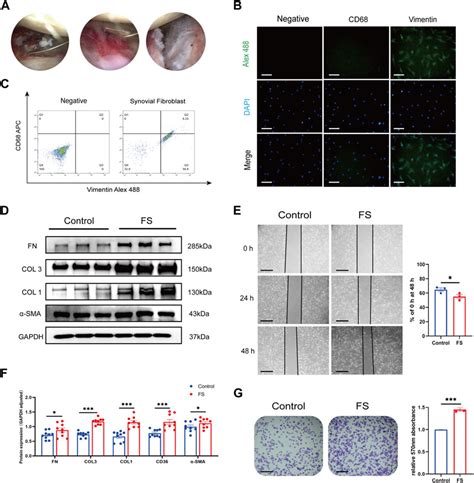 Frontiers Salvianolic Acid B Attenuates Inflammation And Prevent