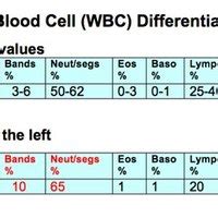 What Is a Shift to the Left in Blood Testing? | eHow