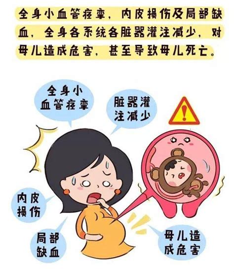 高阳妇幼科普妊娠期高血压别害怕专家教您如何应对 拉贝洛尔