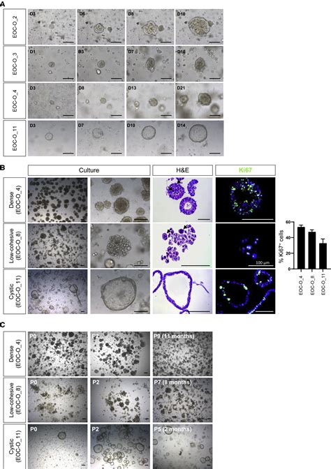 Developing Organoids From Ovarian Cancer As Experimental And