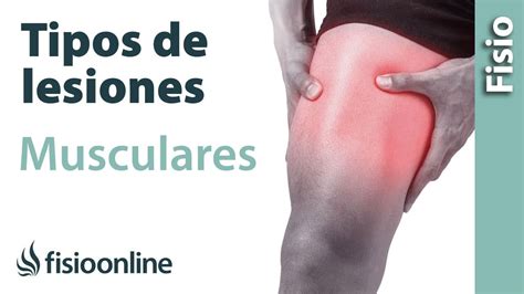 Lesiones Musculares Que Son Tratamientos Causas Sintomas Y Mucho Mas