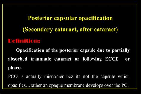 Cataract surgery