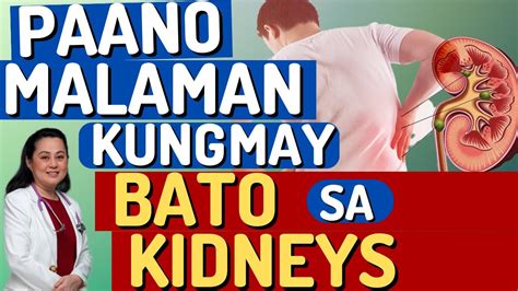 Paano Malaman Kung May Bato Sa Kidneys Prevention Tips By Doc Liza