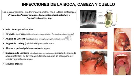 Infecciones Por Anaerobios Youtube