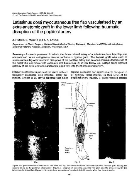 Pdf Latissimus Dorsi Myocutaneous Free Flap Vascularised By An Extra