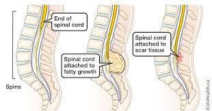 Pediatric Brain Spine Surgeon In Pune Dr Khandelwal