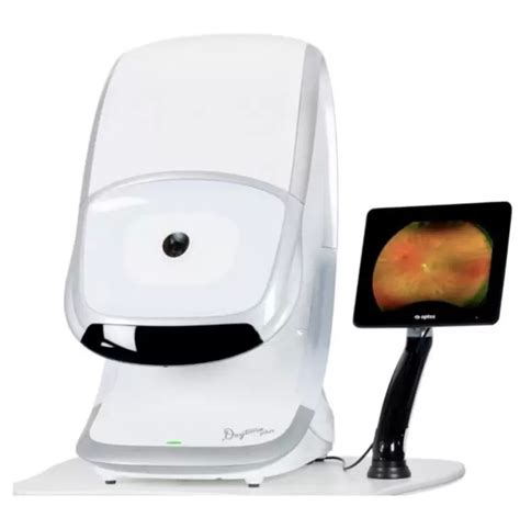 Optomap Retinal Imaging In Fairlawn At Handel Vision Clinic