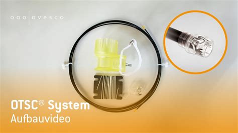 Otsc® System Aufbauvideo Youtube