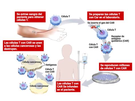 Car T Primer Tratamiento Para Mieloma Aprobado Por La Fda