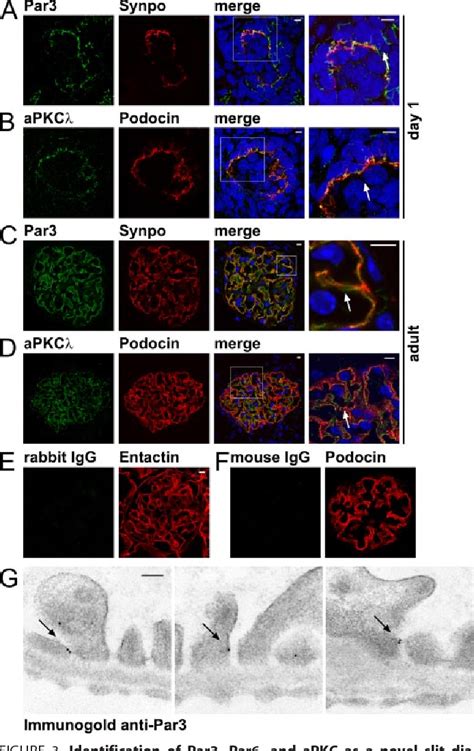 Figure 3 From Neph Nephrin Proteins Bind The Par3 Par6 Atypical Protein