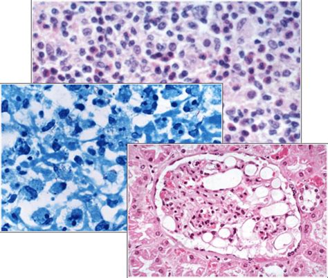 Patho•Log | Create, archive, and share pathology reports for free! 