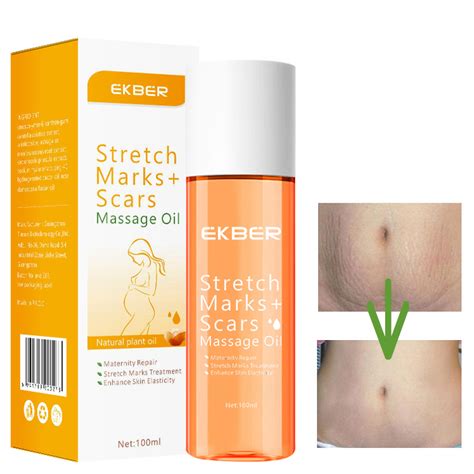 Customize Logo Fade Remove Stretch Marks Post Pregnancy Repairing Stretch Mark Oil China