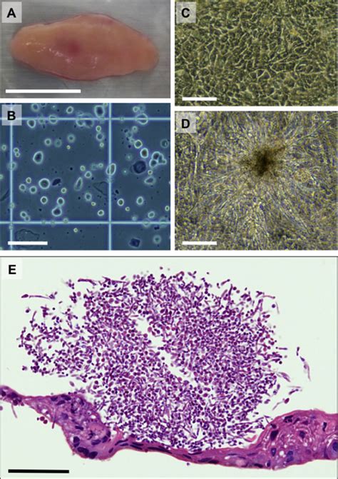 Candida Albicans C Albicans Proliferating In The Cell Culture