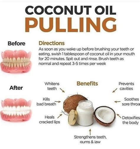 Coconut Oil Benefits For Teeth Oil Pulling Benefits Coconut Oil Pulling Teeth Health