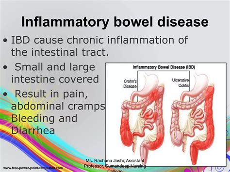 Sitz Bath Procedure Ppt