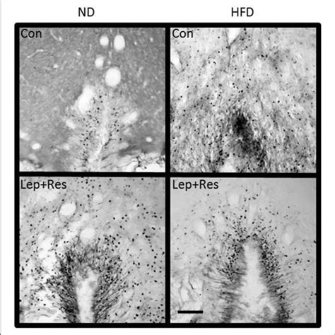 Photomicrographs Showing Fos Positive Cell Nuclei In The Organum