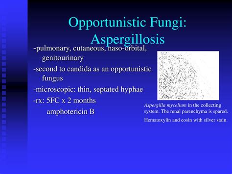 Genitourinary Tb Parasitic And Fungal Infections Ppt Download