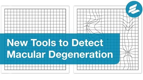 How To Check Your Own Eyes For Macular Degeneration Youtube