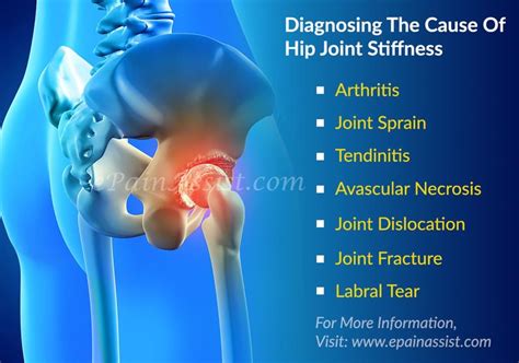 Diagnosing The Cause Of Hip Joint Stiffness Hip Arthritis Arthritis