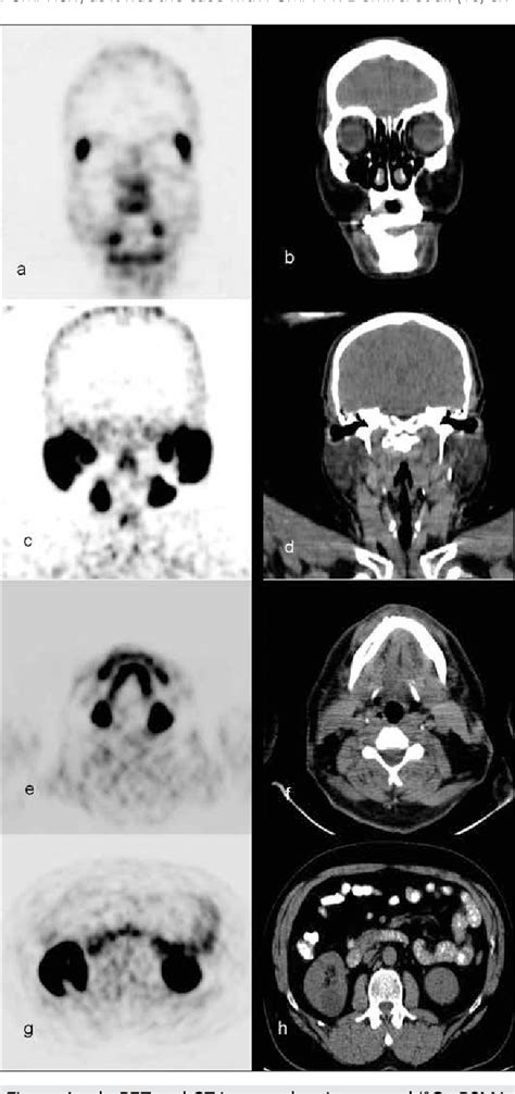 Figure 4 From Assessment Of Physiological Distribution And Normal