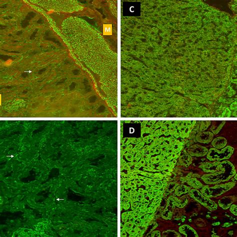 Hep 2 Indirect Immunofluorescence Assay Hep 2 Ifa Patterns Associated Download Scientific