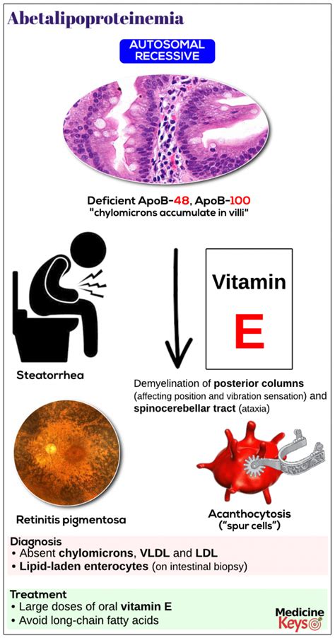 Abetalipoproteinemia - Medicine Keys for MRCPs