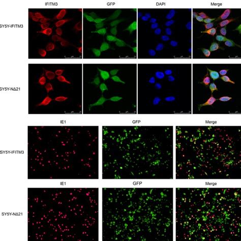 Expression Of Hcmv In Re Brain Tissue Hcmv Pp Protein And Dna Were