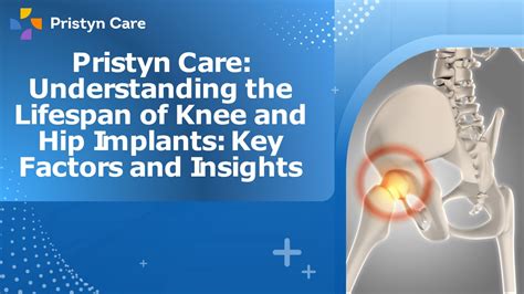 PPT Pristyn Care Understanding The Lifespan Of Knee And Hip Implants