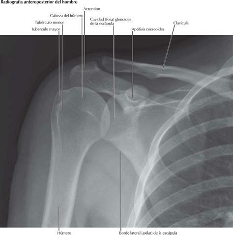 Radiograf A De Hombro Modo Correcto Moda De Hombre