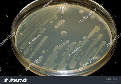 Bacterial Culture On Petri Plate Stock Photo 1454923 | Shutterstock