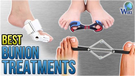 10 Best Bunion Treatments 2018 Youtube