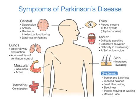 Faqs On Parkinson S Disease Hosiped