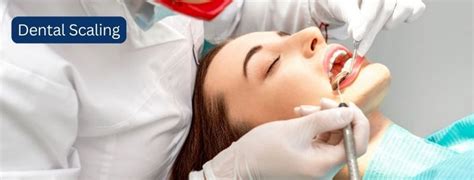 Dental Scaling Teeth Cleaning Diva Dental Clinic Bangalore