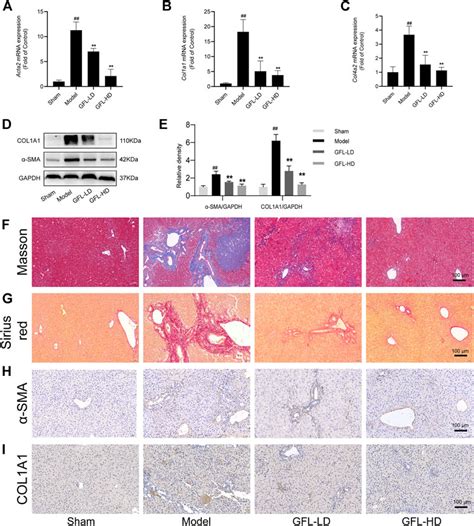 Frontiers Ganfule Capsule Alleviates Bile Duct Ligation Induced Liver