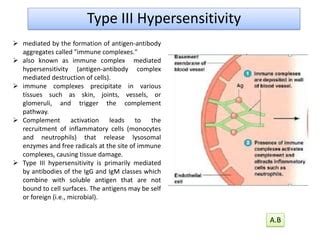 Type III Hypersensitivity | PPT