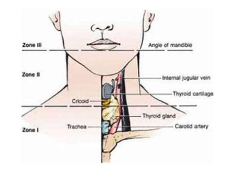 Clinical Anatomy Viscera Of The Neck Ii Flashcards Quizlet