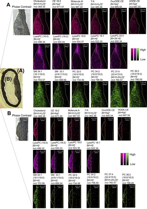 Identification And Visualization Of Oxidized Lipids In Atherosclerotic