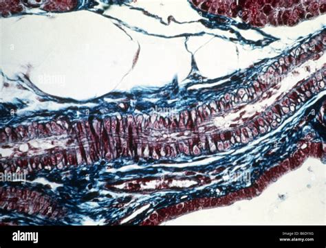 Arteriole Light Micrograph Of A Longitudinal Section Through A Healthy