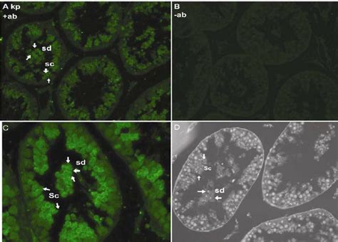 Expression Of Kisspeptin Kp In Seminiferous Tubules Of The Adult